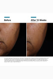 Skinceuticals Age Ultra Serum 30Ml