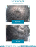 Cystiphane Anti Hair Loss Lotion 125 Ml