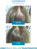 Cystiphane Hair and Nails 120 Tablets