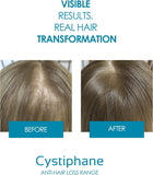 Cystiphane Anti Hair Loss Lotion 125 Ml