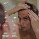 Avalon Avogain 5% Hair Solution, 50ml
