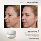 Mesoestetic Cosmelan 2 30gm