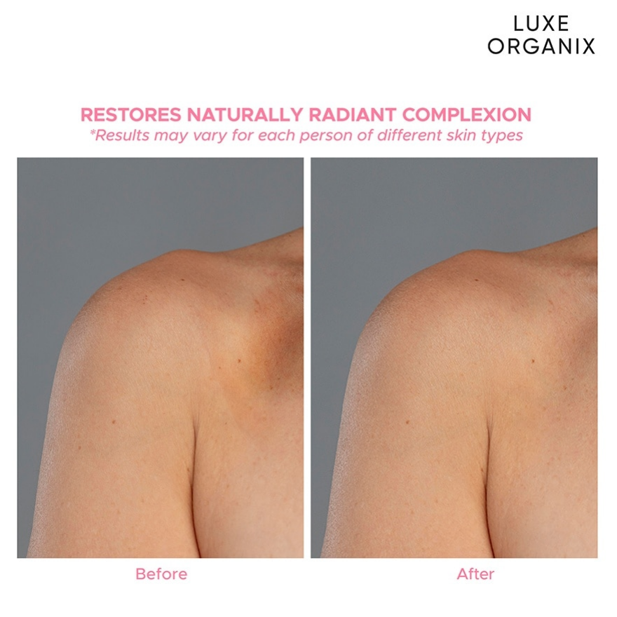 Luxe Organix Niacinamide+Arbutin Whitening Serum Lotion 350Ml
