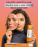 Dermoren Cream 20% Azelaic Acid 30g